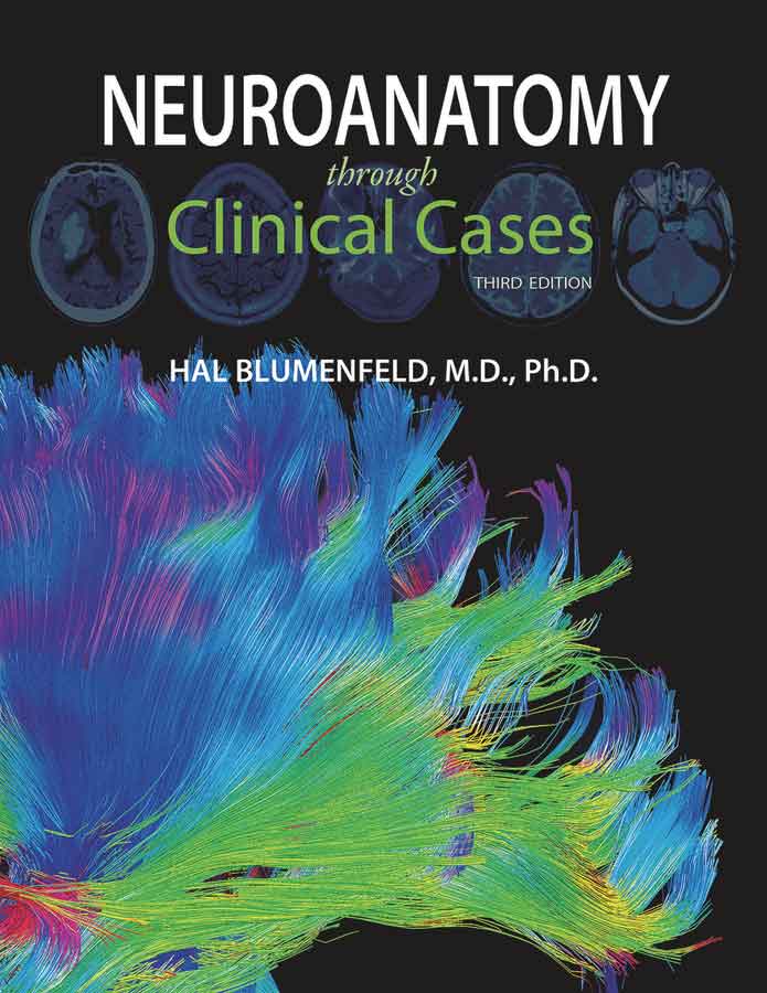 Neuroanatomy Through Clinical Cases